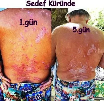 Sindirgi Eman Thermal Hotel Ilicali