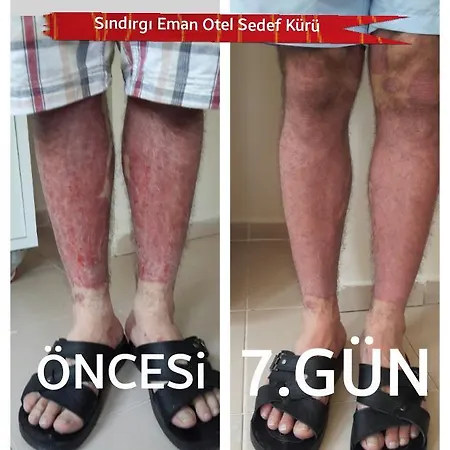 Sindirgi Eman Thermal